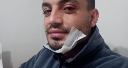 Hastaneye Kaldırıldı